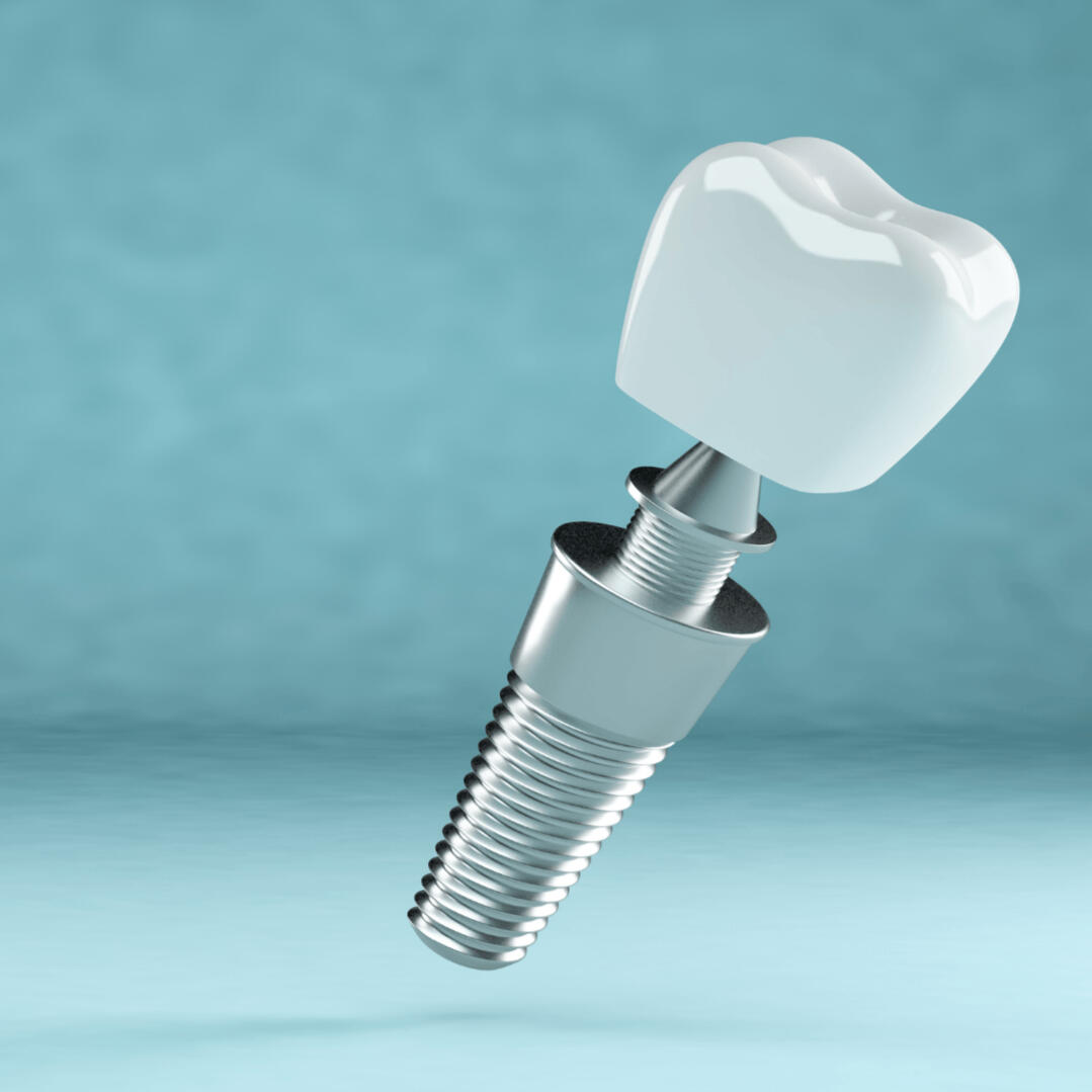 Dental implants We offer all sorts of of treatments like dental implants.